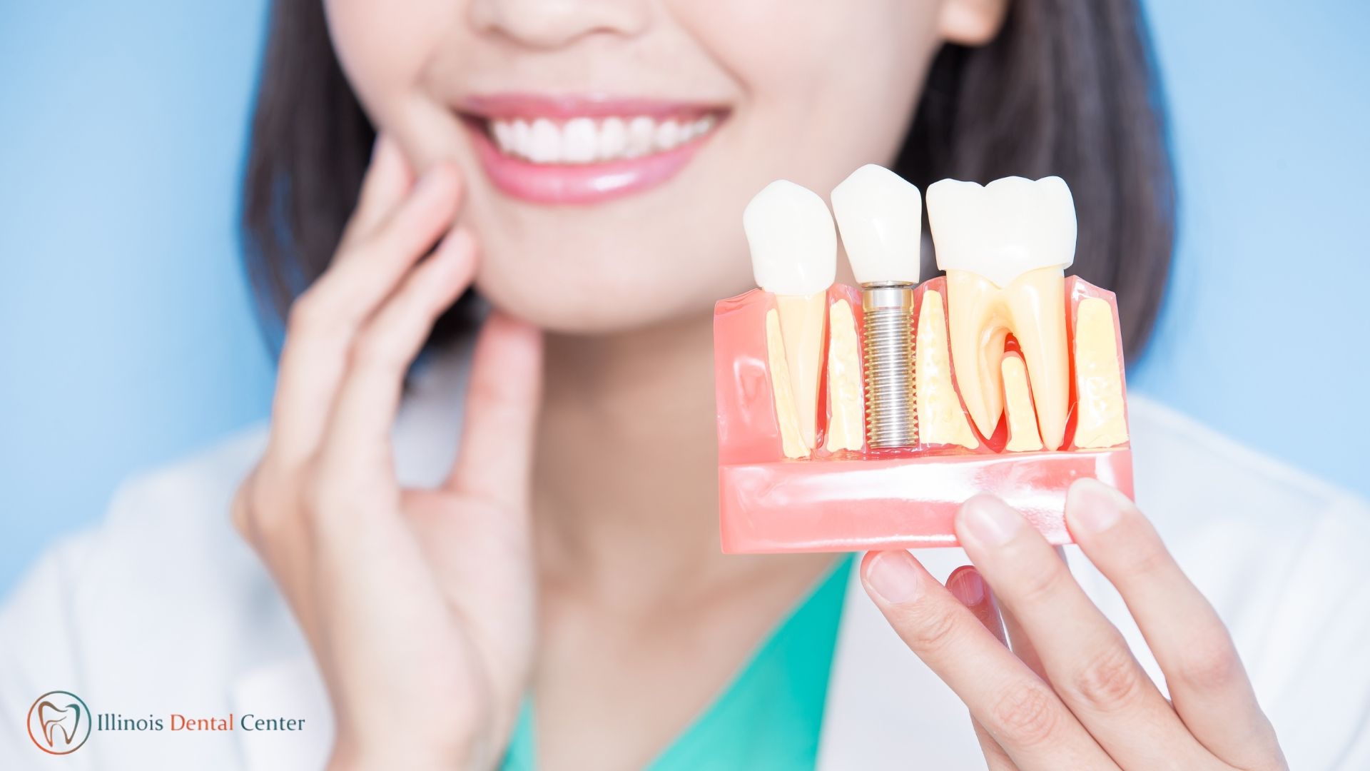 Are you looking for dental implant services in Wheeling, IL?
