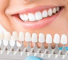 Cosmetic Dentistry in Houston Heights