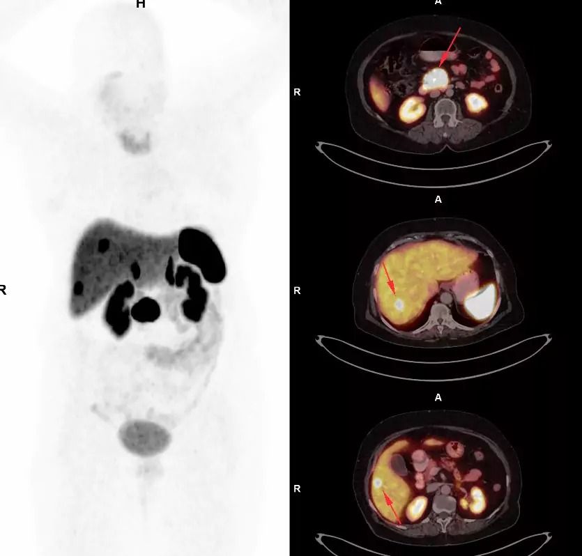 Transparent DOTA Scan Price in Mumbai – Picture This 