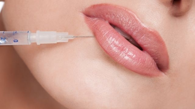 Lip fillers in Riyadh